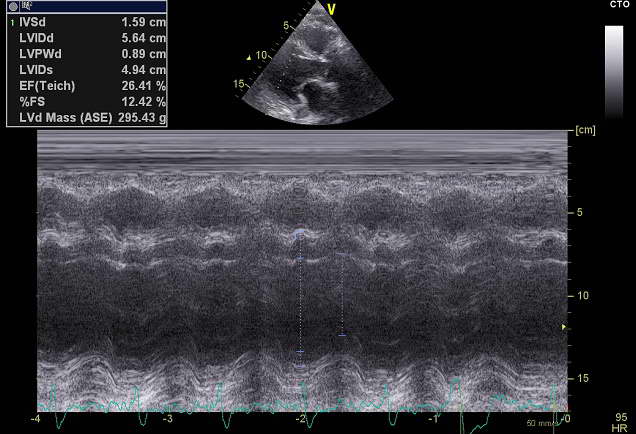 Cardiac ultrasound M-mode